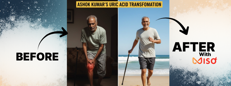 A BEFORE AND AFTER visual comparison titled ASHOK KUMAR'S URIC ACID TRANSFOMATION. The BEFORE image on the left shows an older man indoors grimacing and holding his painful, swollen knee while leaning on a cane. The AFTER with MISO image on the right shows the same man smiling,  jogging lightly on a sunny beach, still holding his cane but now using it for support rather than pain, suggesting relief from joint pain and improved mobility.