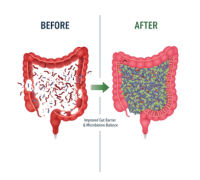 Before and after gut health visualization showing improved digestion and balanced microbiome